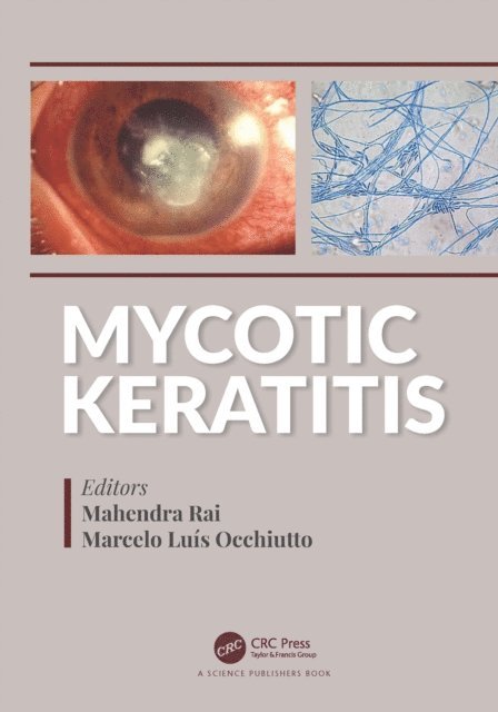 Marcelo Luis Occhiutto, Mahendra Rai - Mycotic Keratitis, E-bok