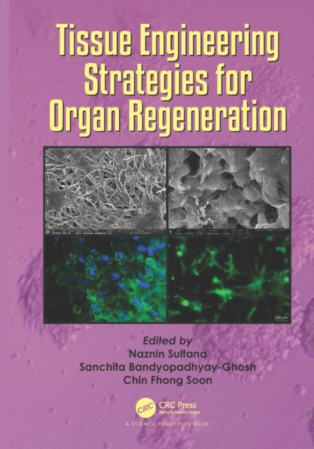 Tissue Engineering Strategies for Organ Regeneration