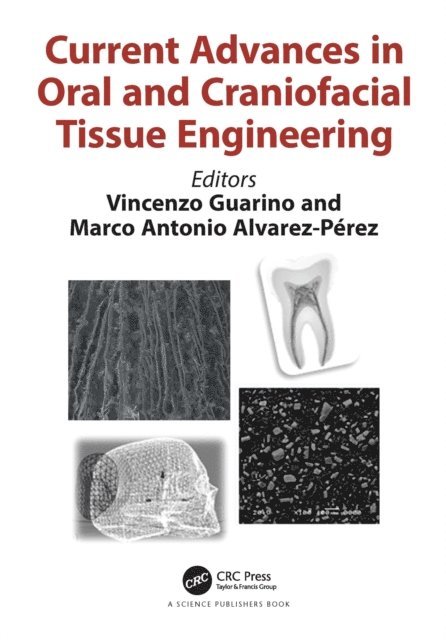 Marco Antonio Alverez-Perez, Vincenzo Guarino - Current Advances in Oral and Craniofacial Tissue Engineering, E-bok