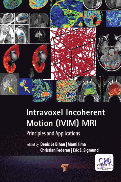 Eric E. Sigmund, Christian Federau, Mami Iima, Denis Le Bihan - Intravoxel Incoherent Motion (IVIM) MRI, E-bok