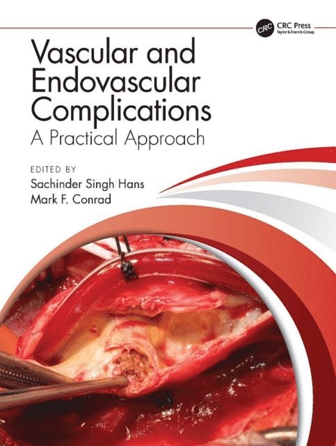 Mark F Conrad, Sachinder Singh Hans - Vascular and Endovascular Complications: A Practical Approach, E-bok. Tillgänglighet: Lägg i varukorg