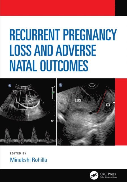 Minakshi Rohilla - Recurrent Pregnancy Loss and Adverse Natal Outcomes, E-bok