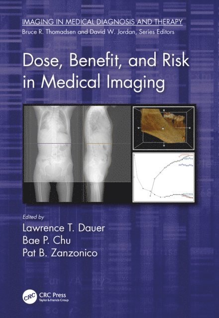 Pat B. Zanzonico, Bae P. Chu, Lawrence T. Dauer - Dose, Benefit, and Risk in Medical Imaging, E-bok