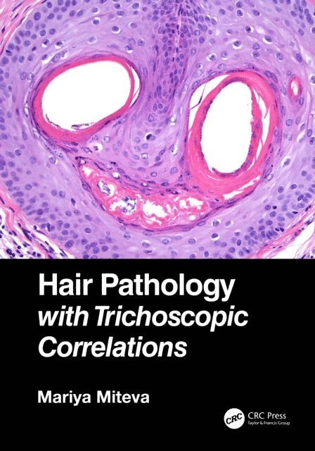 Mariya Miteva - Hair Pathology with Trichoscopic Correlations, E-bok. Tillgänglighet: Lägg i varukorg