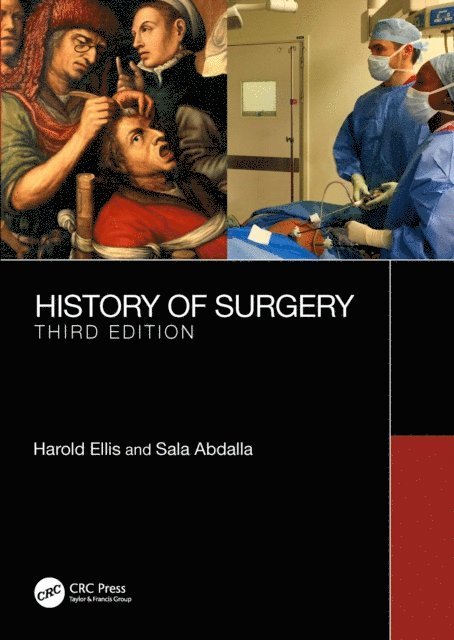 Sala Abdalla, Harold Ellis - History of Surgery, E-bok
