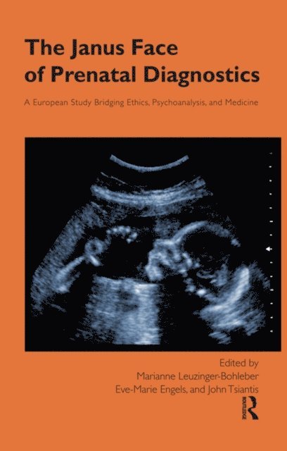 John Tsiantis, Marianne Leuzinger-Bohleber, Eve-Marie Engels - Janus Face of Prenatal Diagnostics, E-bok