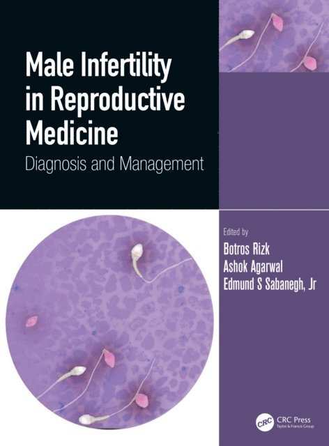 Edmund Sabanegh Jr., Ashok Agarwal, Botros Rizk - Male Infertility in Reproductive Medicine, E-bok