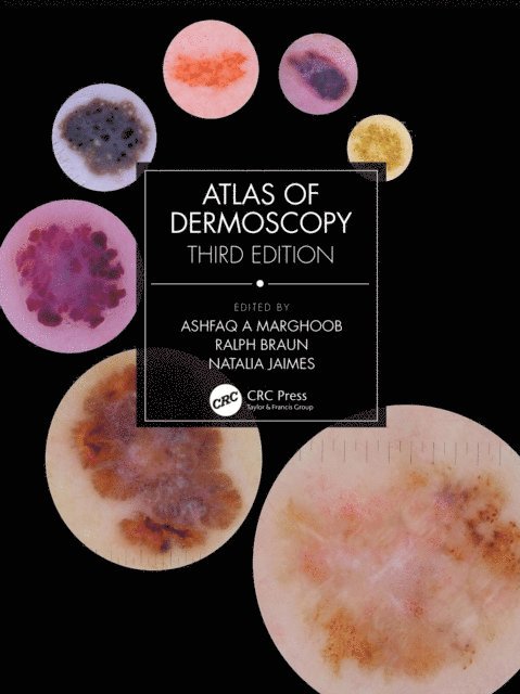 Natalia Jaimes, Ralph Braun, Ashfaq A Marghoob - Atlas of Dermoscopy, E-bok