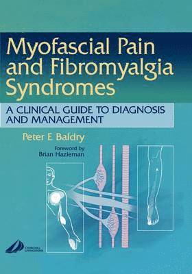 Peter E. Baldry - Myofascial Pain and Fibromyalgia Syndromes, Inbunden. Tillgänglighet: Lägg i varukorg