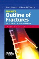 David L. Hamblen, Hamish Simpson - Adams's Outline of Fractures, Häftad