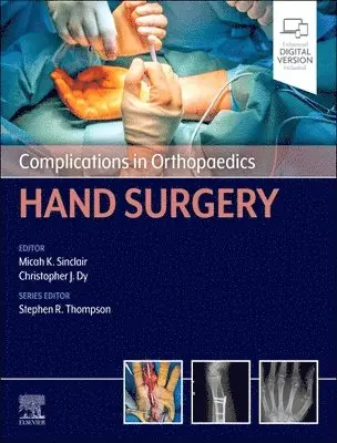 Micah K. Sinclair, Christopher Dy - Complications in Orthopaedics: Hand Surgery, Inbunden