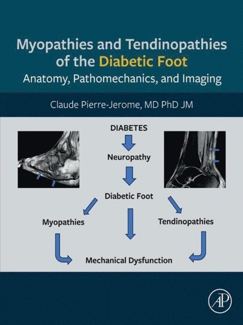 Claude Pierre-Jerome - Myopathies and Tendinopathies of the Diabetic Foot, E-bok