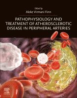 Aloke Virmani Finn - Pathophysiology and Treatment of Atherosclerotic Disease in Peripheral Arteries, Häftad. Tillgänglighet: Lägg i varukorg