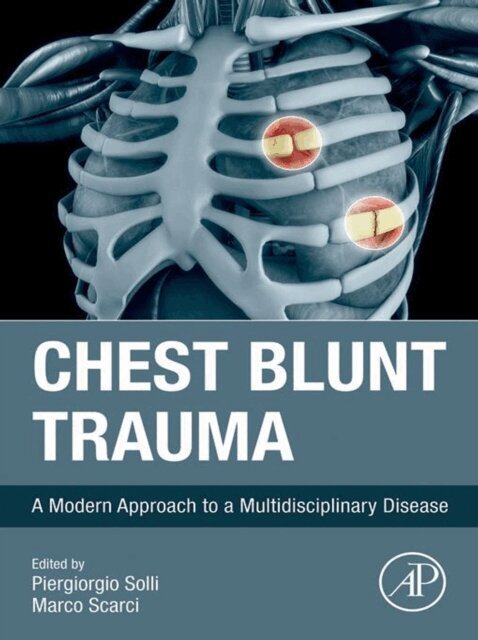 Marco Scarci, Piergiorgio Solli - Chest Blunt Trauma, E-bok
