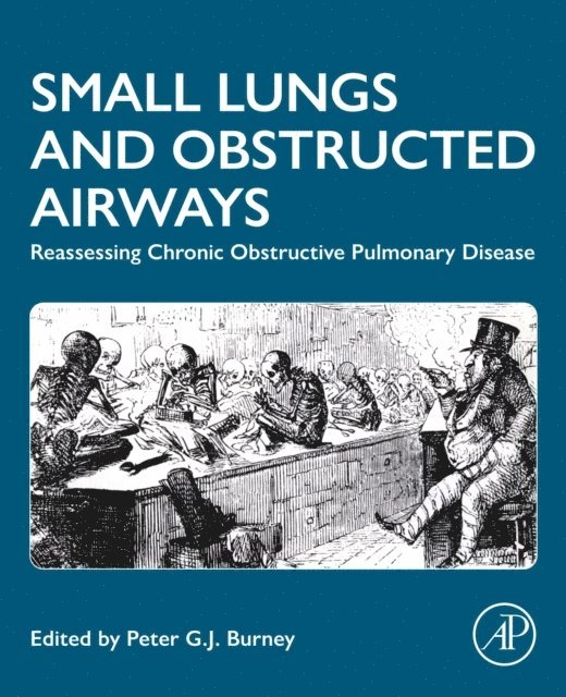 Peter Burney - Small Lungs and Obstructed Airways, E-bok. Tillgänglighet: Lägg i varukorg