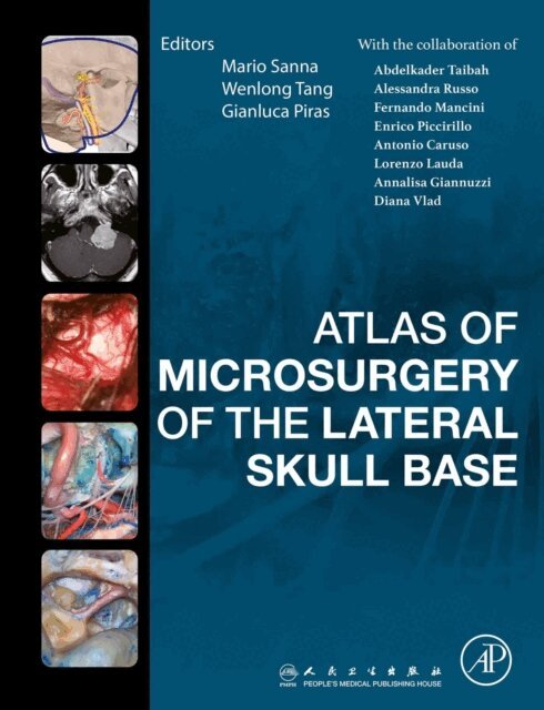 Fernando Mancini, Alessandra Russo, Abdelkader Taibah, Wenlong Tang, Gianluca Piras, Mario Sanna - Atlas of Microsurgery of the Lateral Skull Base, E-bok