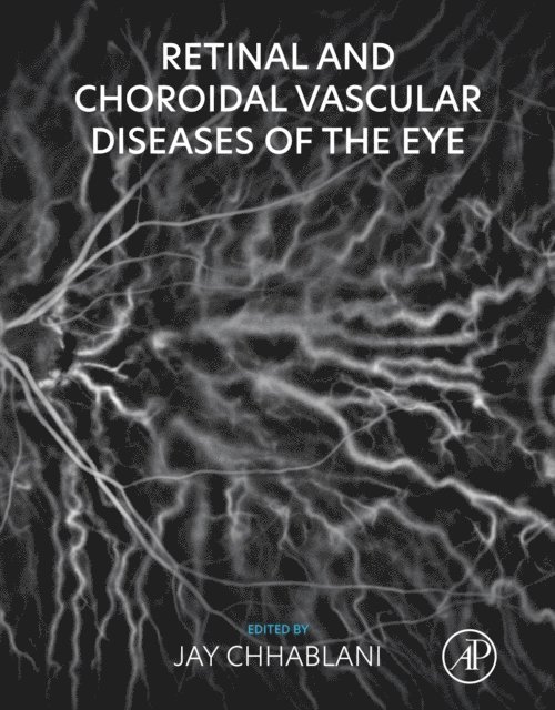Jay Chhablani - Retinal and Choroidal Vascular Diseases of the Eye, E-bok