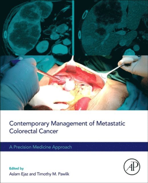 Timothy M. Pawlik, Aslam Ejaz - Contemporary Management of Metastatic Colorectal Cancer, E-bok