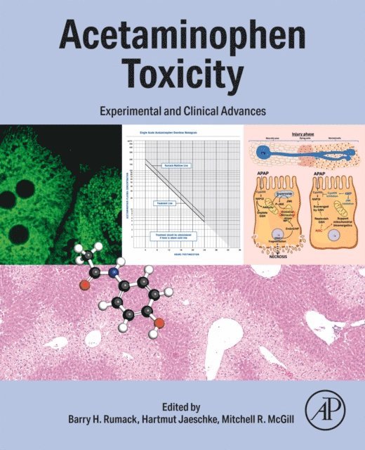 Mitchell McGill, Hartmut Jaeschke, Barry Rumack - Acetaminophen Toxicity, E-bok