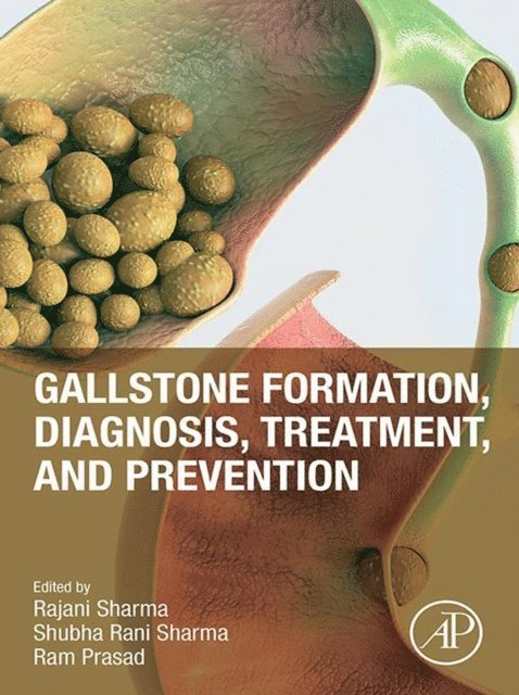 Ram Prasad, Shubha rani sharma, Rajani Sharma - Gallstone Formation, Diagnosis, Treatment and Prevention, E-bok