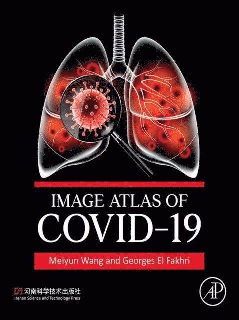 Georges El Fakhri, Meiyun Wang - Image Atlas of COVID-19, E-bok. Tillgänglighet: Lägg i varukorg