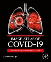 Image Atlas of COVID-19