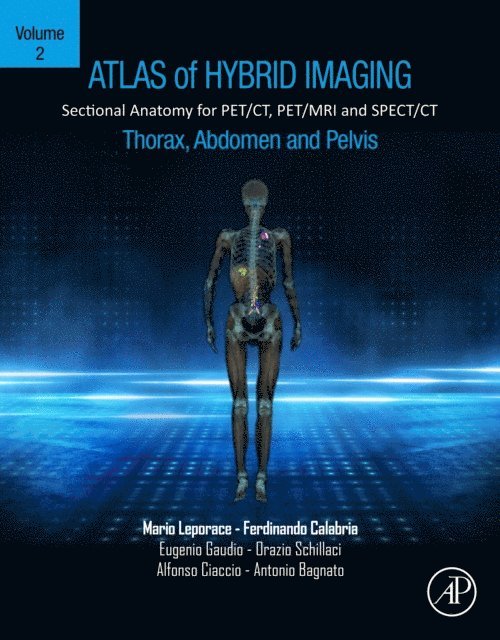 Antonio Bagnato, Alfonso Ciaccio, Orazio Schillaci, Eugenio Gaudio, Ferdinando Calabria, Mario Leporace - Atlas of Hybrid Imaging Sectional Anatomy for PET/CT, PET/MRI and SPECT/CT Vol. 2: Thorax Abdomen and Pelvis, E-bok