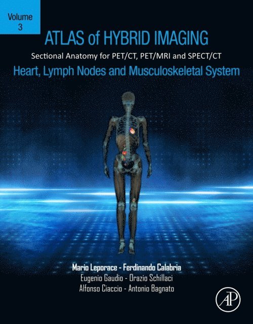 Antonio Bagnato, Alfonso Ciaccio, Orazio Schillaci, Eugenio Gaudio, Ferdinando Calabria, Mario Leporace - Atlas of Hybrid Imaging Sectional Anatomy for PET/CT, PET/MRI and SPECT/CT Vol. 3: Heart, Lymph Node and Musculoskeletal System, E-bok