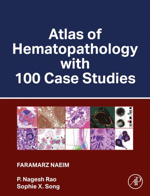 Sophie X. Song, P. Nagesh Rao, Faramarz Naeim - Atlas of Hematopathology with 100 Case Studies, E-bok