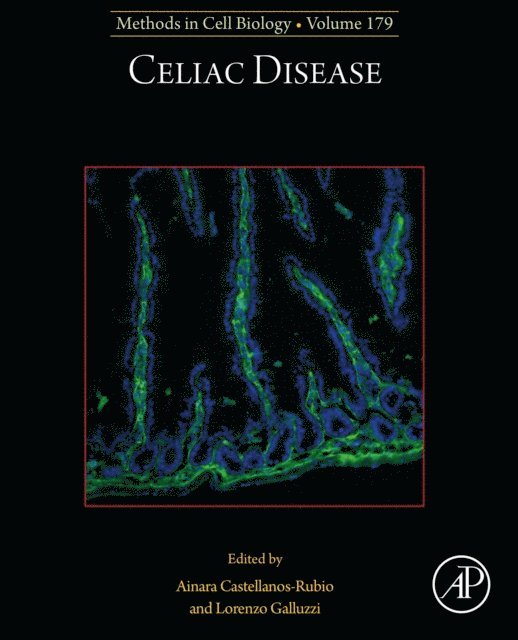 Celiac Disease, E-bok