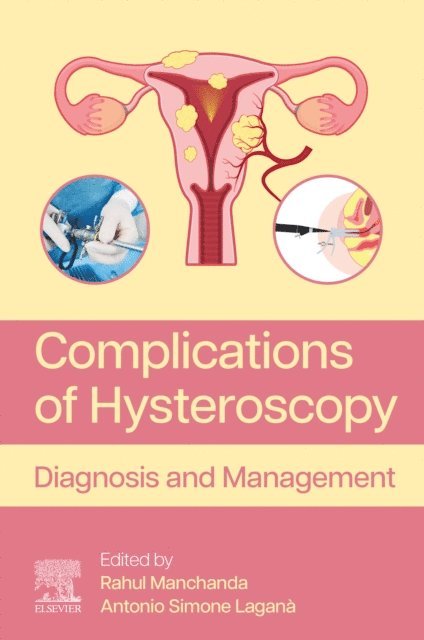 Antonio Simone Lagana, Rahul Manchanda - Complications of Hysteroscopy, E-bok