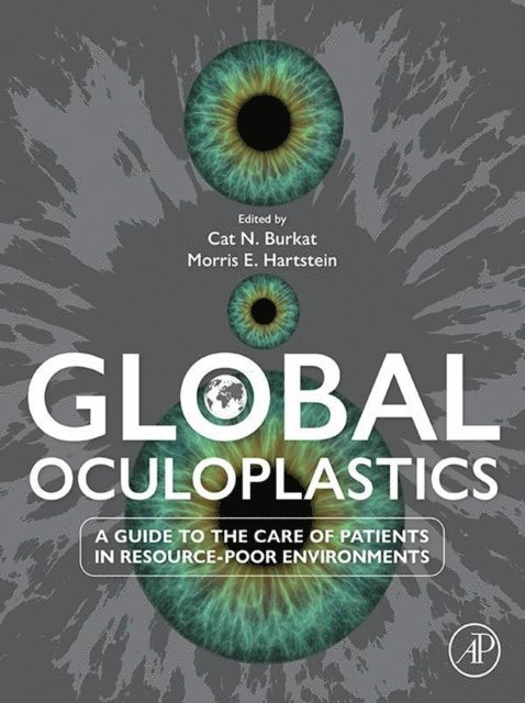 Cat Nguyen Burkat, Morris E Hartstein - Global Oculoplastics, E-bok