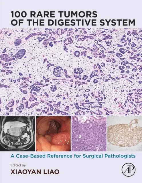 Xiaoyan Liao - 100 Rare Tumors of the Digestive System, E-bok. Tillgänglighet: Lägg i varukorg
