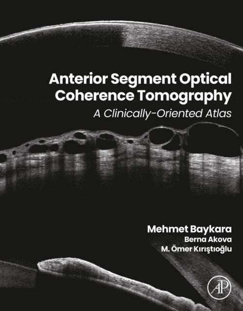 M. Omer Kiristioglu, Berna Akova, Mehmet Baykara - Anterior Segment Optical Coherence Tomography, E-bok. Tillgänglighet: Lägg i varukorg