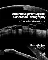 Anterior Segment Optical Coherence Tomography