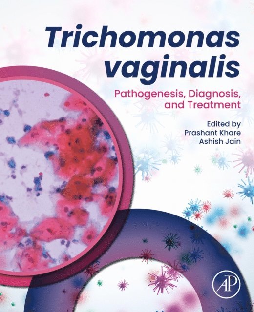 Ashish Jain, Prashant Khare - Trichomonas vaginalis, E-bok