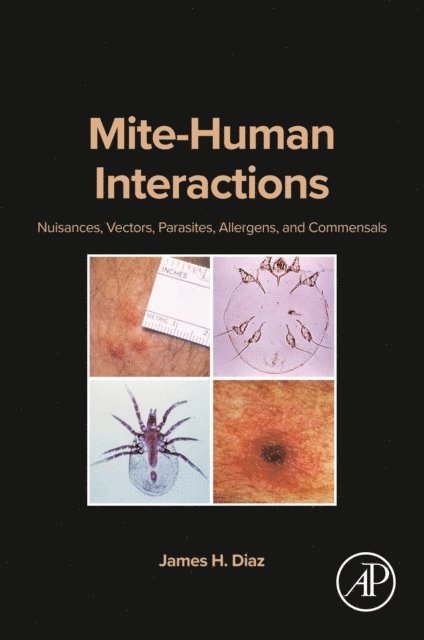 James H. Diaz - Mite-Human Interactions, E-bok