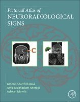 Athena Sharifi-Razavi, Amir Moghadam Ahmadi, Ashkan Mowla - Pictorial Atlas of Neuroradiological Signs, Häftad