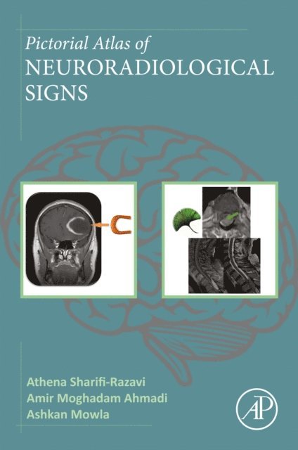 Ashkan Mowla, Amir Moghadam Ahmadi, Athena Sharifi-Razavi - Pictorial Atlas of Neuroradiological Signs, E-bok