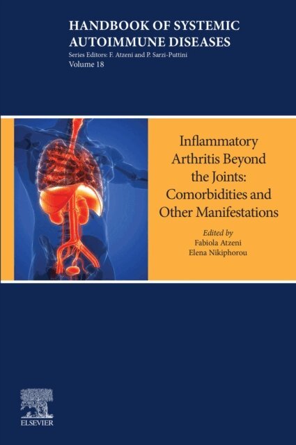 Elena Nikiphorou, Fabiola Atzeni - Inflammatory Arthritis Beyond the Joints, E-bok