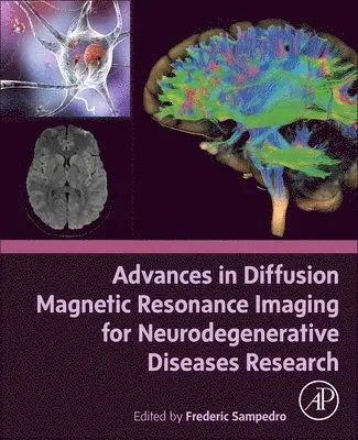 Advances in Diffusion Magnetic Resonance Imaging for Neurodegenerative Diseases Research