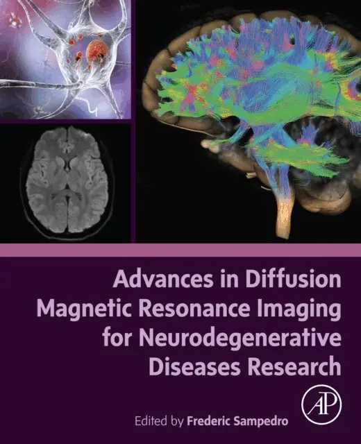 Frederic Sampedro - Advances in Diffusion Magnetic Resonance Imaging for Neurodegenerative Diseases Research, E-bok. Tillgänglighet: Lägg i varukorg