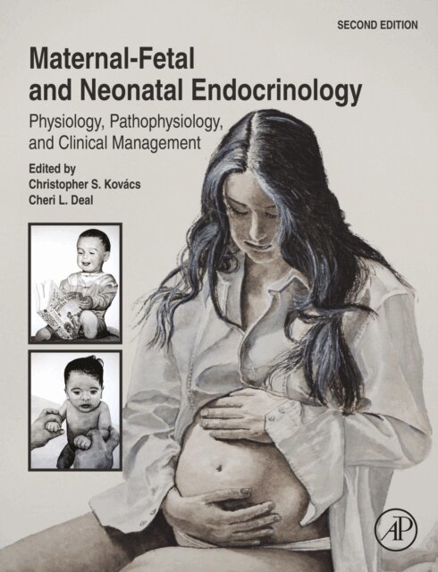 Cheri L. Deal, Christopher S. Kovacs - Maternal-Fetal and Neonatal Endocrinology, E-bok