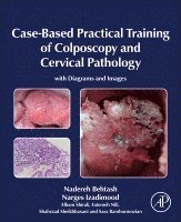 Case-Based Practical Training of Colposcopy and Cervical Pathology