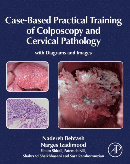 Sara Ramhormozian, Shahrzad Sheikhhasani, Fatemeh Nili, Elham Shirali, Narges Izadimood, Nadereh Behtash - Case-Based Practical Training of Colposcopy and Cervical Pathology, E-bok. Tillgänglighet: Lägg i varukorg