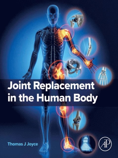 Thomas J Joyce - Joint Replacement in the Human Body, E-bok. Tillgänglighet: Lägg i varukorg