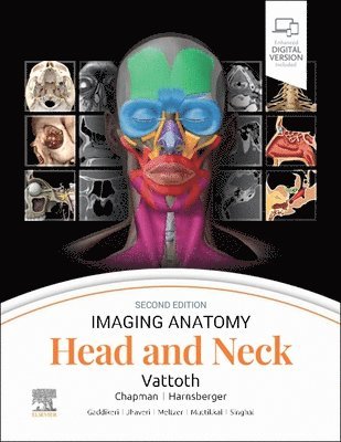 Surjith Vattoth - Imaging Anatomy: Head and Neck, Inbunden. Tillgänglighet: Lägg i varukorg