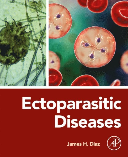 James H. Diaz - Ectoparasitic Diseases, E-bok