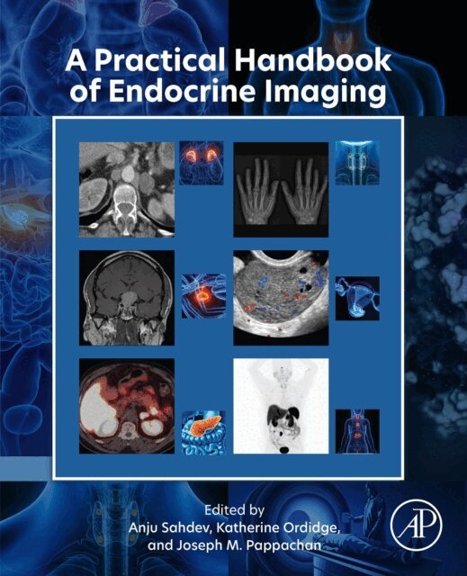 Katherine Ordidge, Anju Sahdev, Joseph M. Pappachan - Practical Handbook of Endocrine Imaging, E-bok