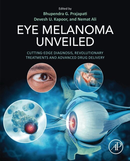 Nemat Ali, Devesh U. Kapoor, Bhupendra G. Prajapati - Eye Melanoma Unveiled, E-bok